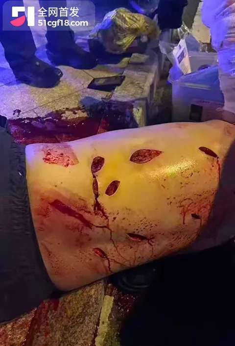 福建石狮八卦街醉酒杀人 1 拷贝 福建石狮八卦街醉酒杀人 1 拷贝